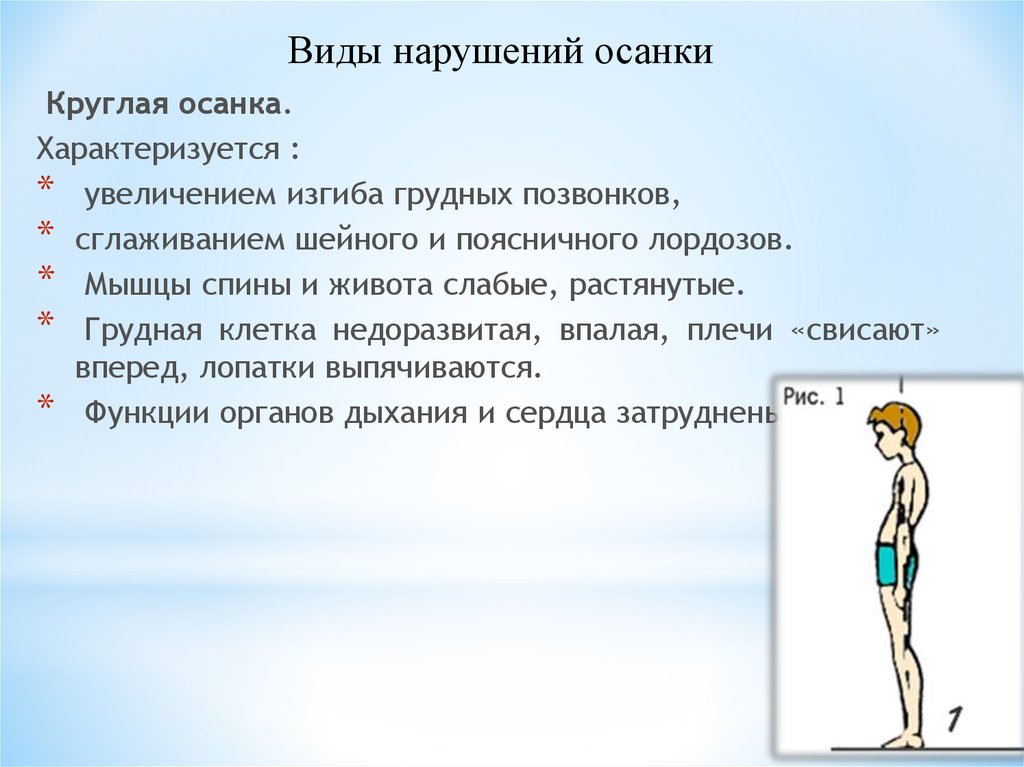 Причины нарушения осанки. Типы нарушения осанки. Профилактика нарушения осанки. Профилактика нарушения осанки у детей. Типы осанки у детей.