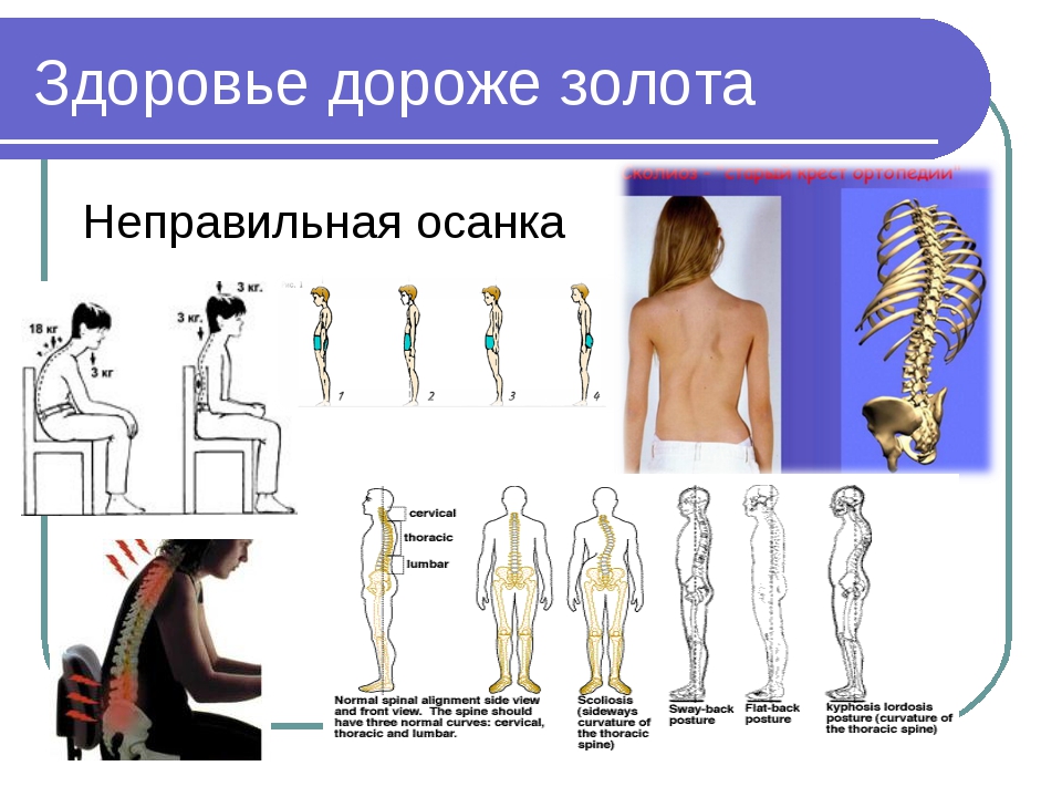 Коррекция осанки и телосложения презентация